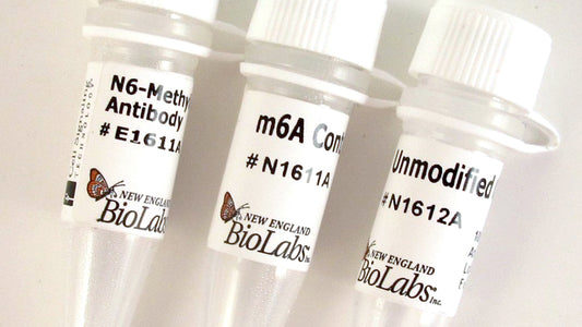 NEB EpiMark N6-Methyladenosine Enrichment Kit (Cat No. E1610)